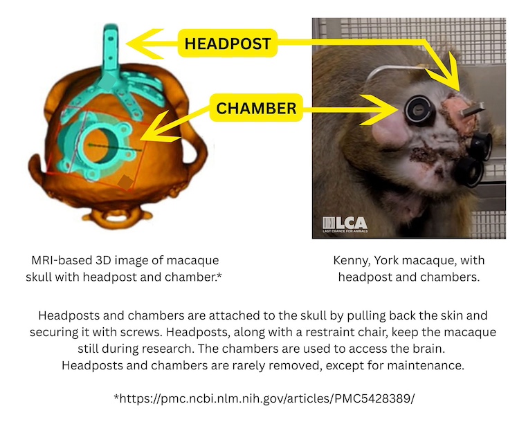 images of headpost and chaber impants