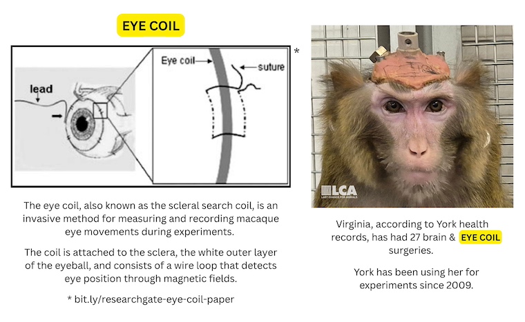image of eye coil